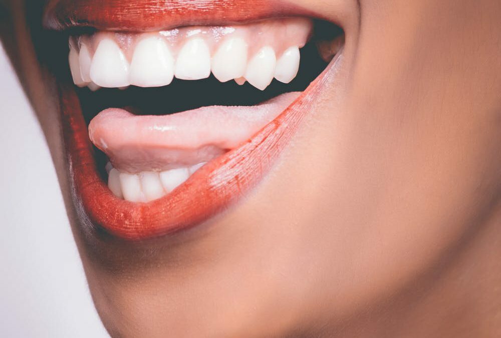 Diverse manieren om je tanden te bleken